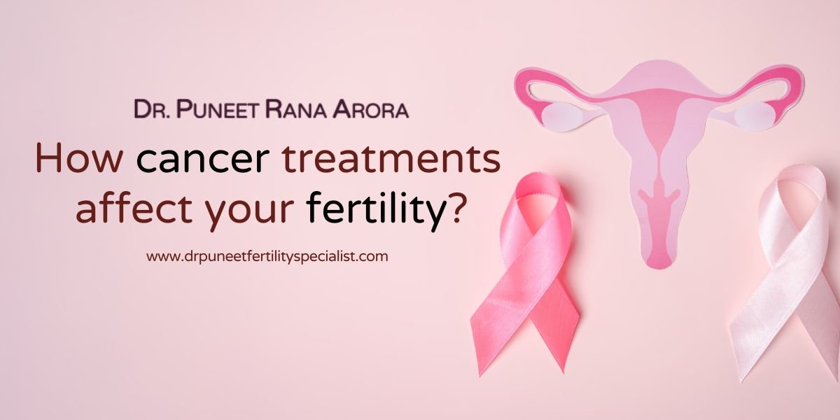 Effect of Cancer Treatment on Fertility