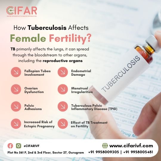 tb infertility