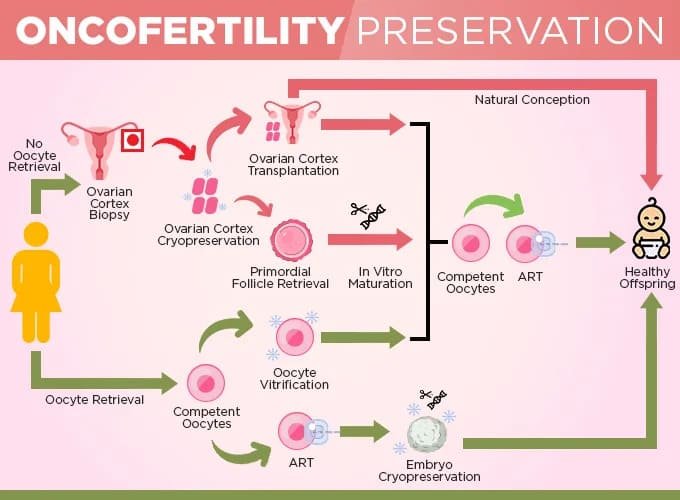 Oncofertility