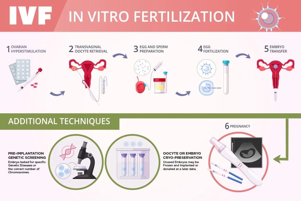 IVF-ICSI Treatment with Self Oocytes at CIFAR IVF Centre